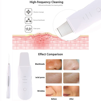 Ultrasonic Skin Scrubber